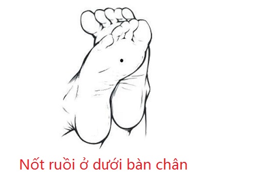 Not ruoi o duoi ban chan noi chung